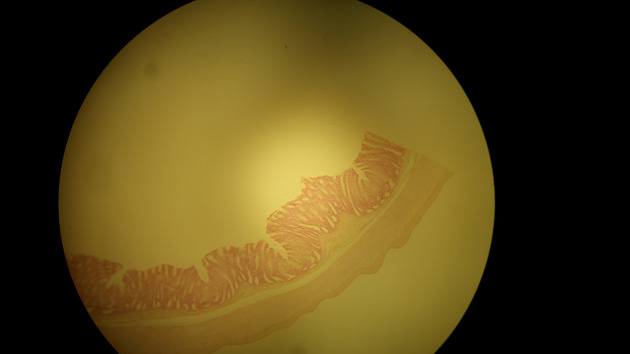 Colon Slides - Colon 004 40X